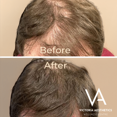 Scalp assessment and treatment