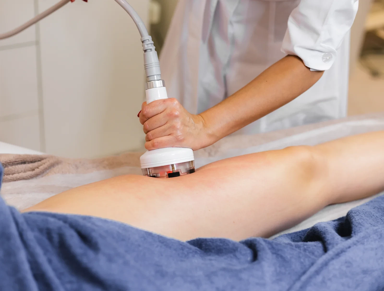 A woman's side profile showing skin tightening and body contouring results from radiofrequency treatment.