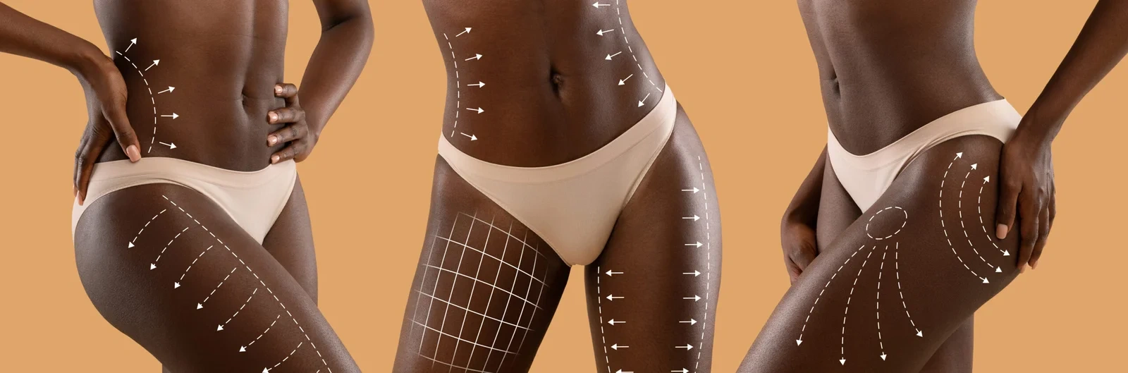 BEST TREATMENT TO BURN FAT QUICKLY: THE TRUTH BEHIND INJECTIONS THAT DISSOLVE LOCALISED FAT