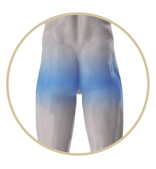 Diagram for gluteus augmentation and toning with Wonder